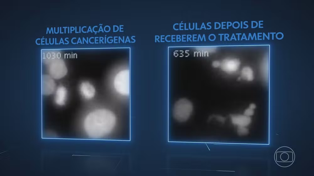NOVO MÉTODO DE COMBATE AO CÂNCER É DESENVOLVIDO POR BIOMÉDICO BRASILEIRO