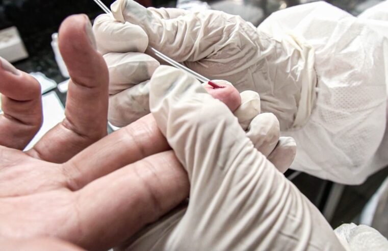 JULHO AMARELO REFORÇA A PREVENÇÃO ÀS HEPATITES VIRAIS EM FERRAZ